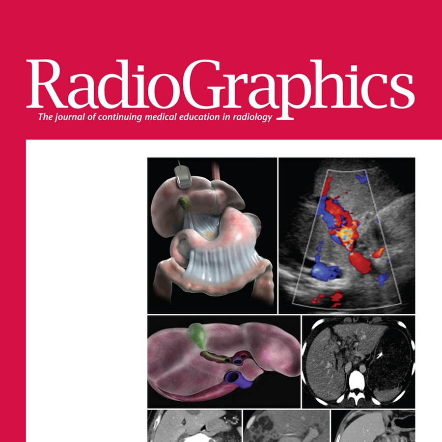 RadioGraphics - YouTube
