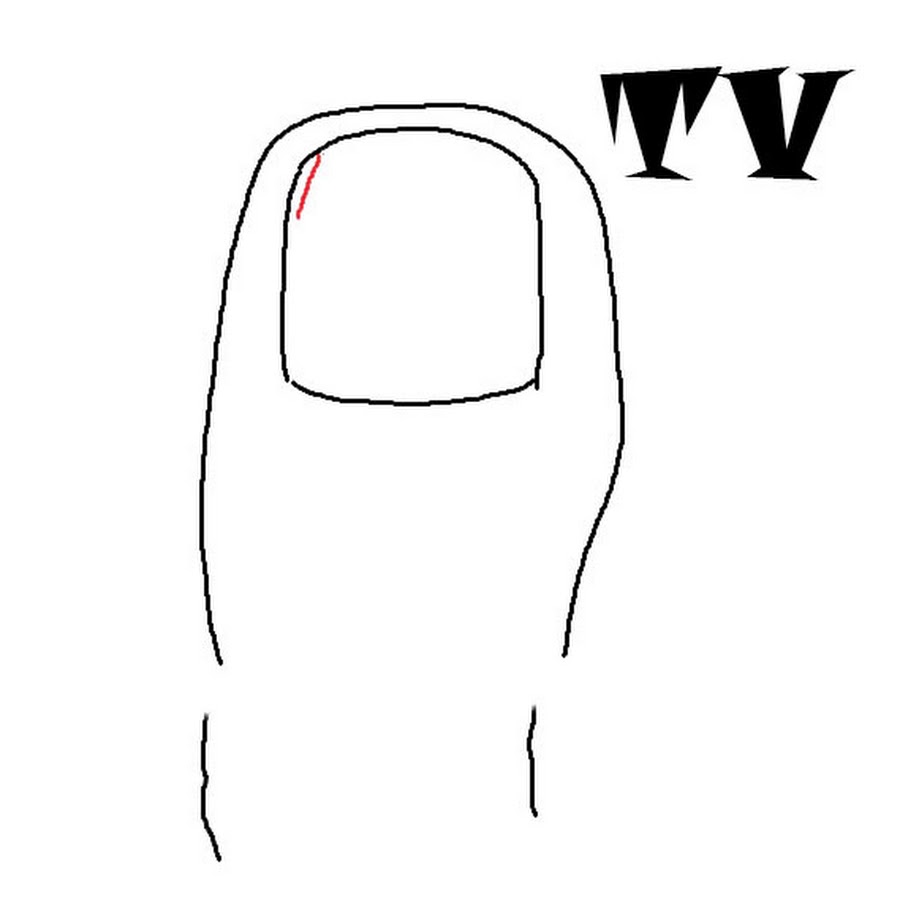 My Image 88