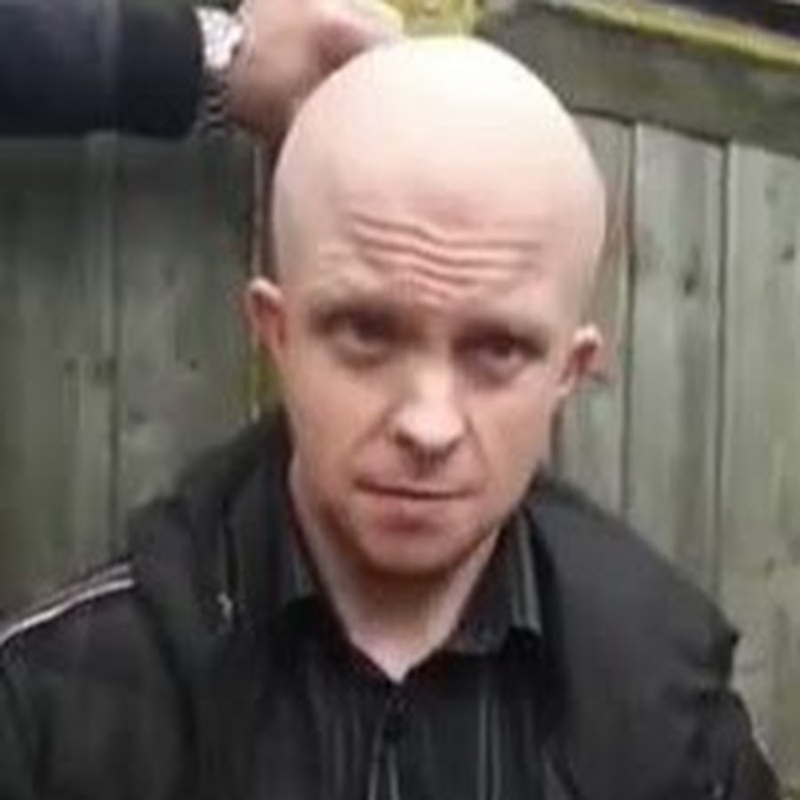 Bald Nonce - YouTube
