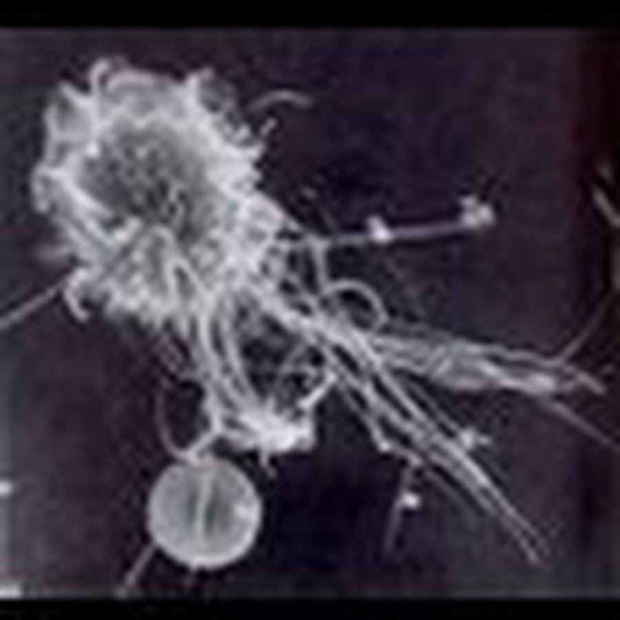 микрофотографии гистология. бактерии в слюне под микроскопом. слюна под микроскопом. клетка слюны человека под микроскопом. вирус covid 19 под микроскопом.