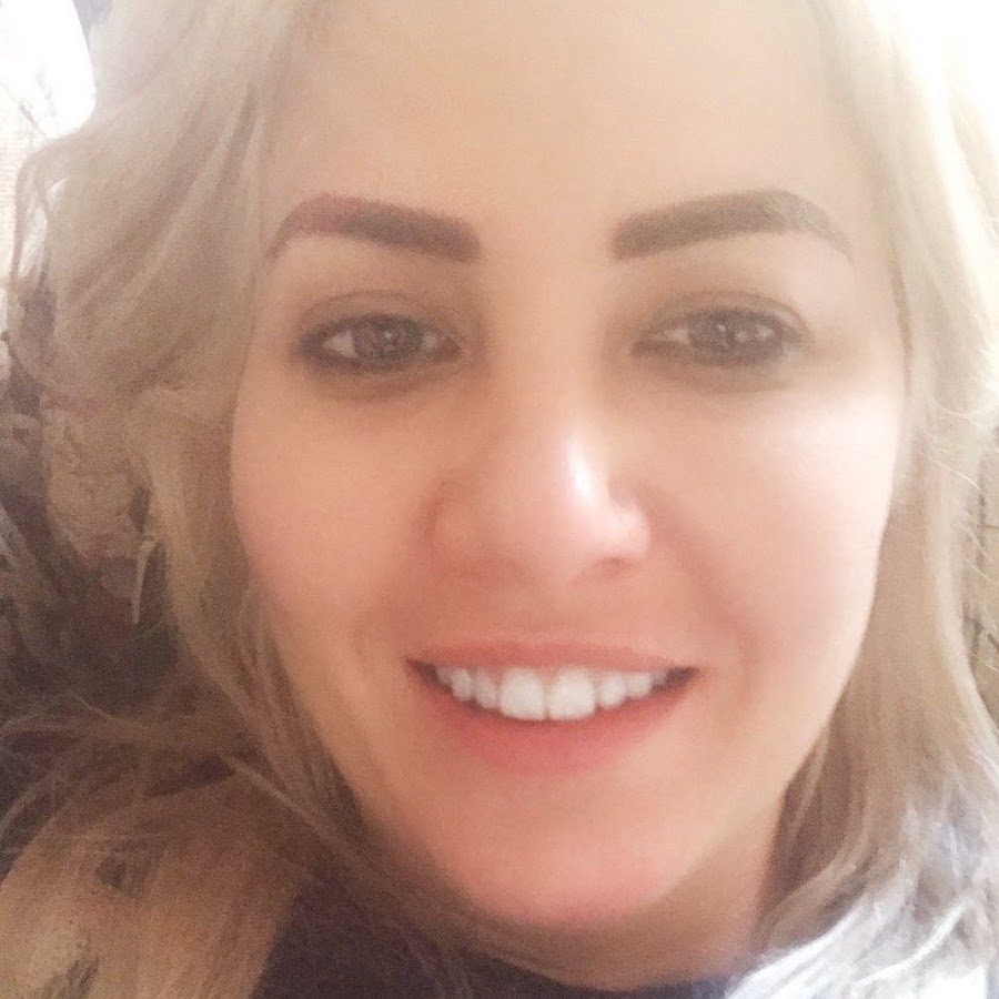 I might have Mites - YouTube