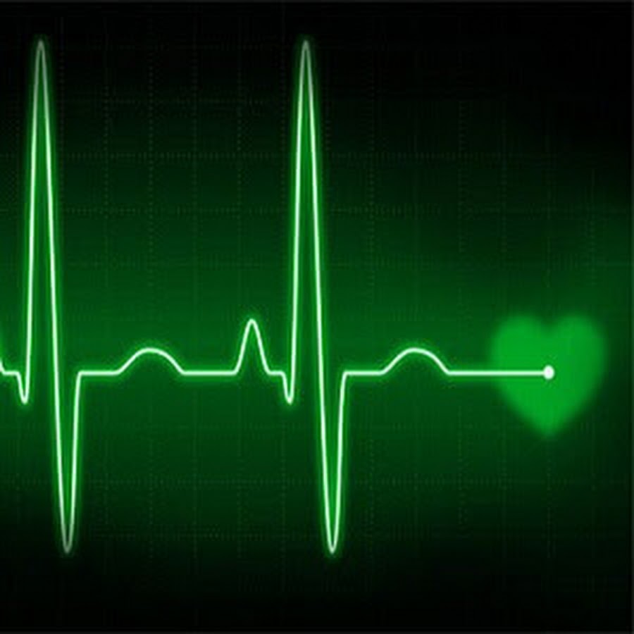 ритм пульса. "ритм" (сердечный). апноэ график. ритм сердца. второй пульс.