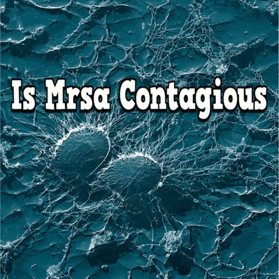 Is Mrsa Contagious YouTube