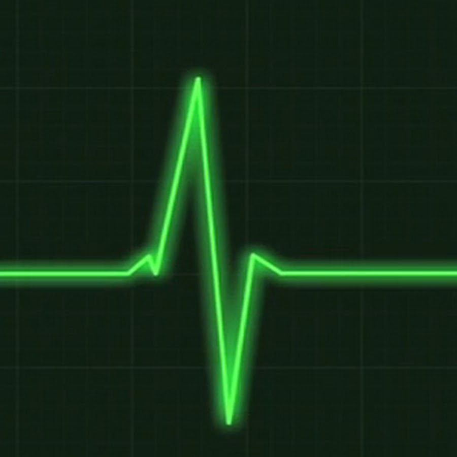 Jbl pulse 5 bluetooth. Пульс при смерти. Пульс. Колонка jbl pulse 5. Jbl pulse 5 black.