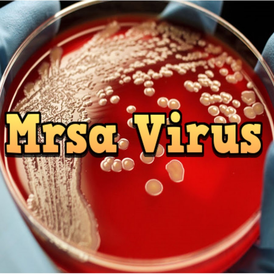 Mrsa Virus YouTube