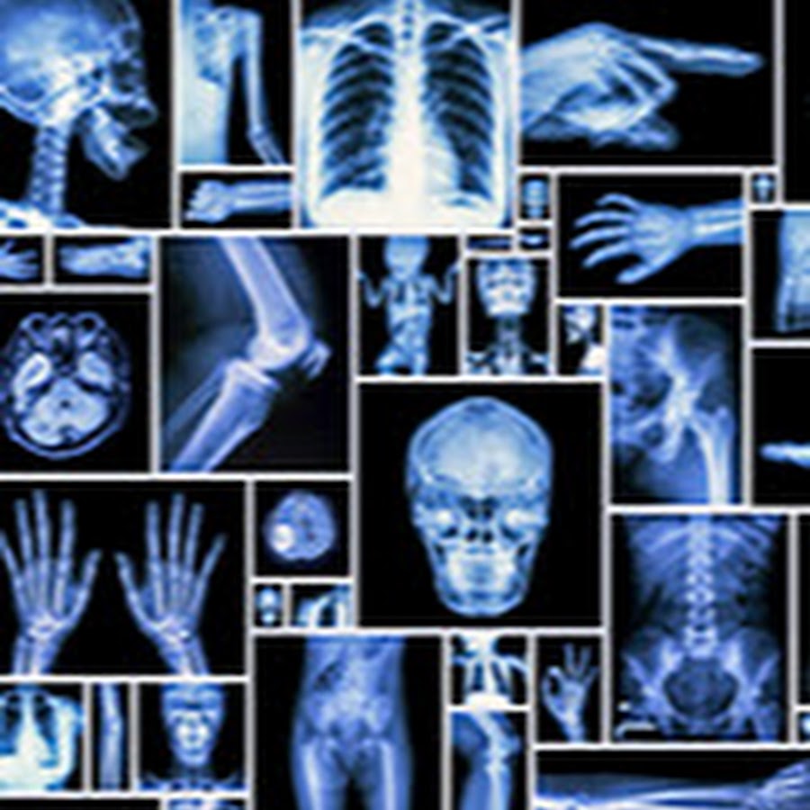 Radiology School YouTube