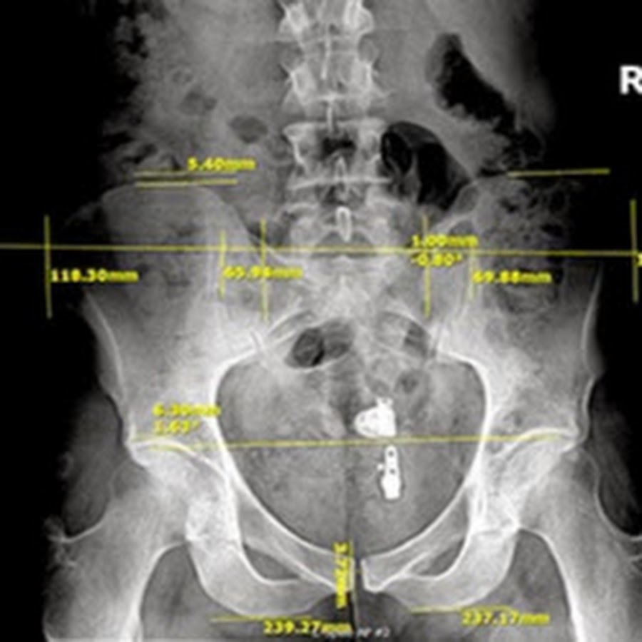 Chiropractic Digital XRay YouTube