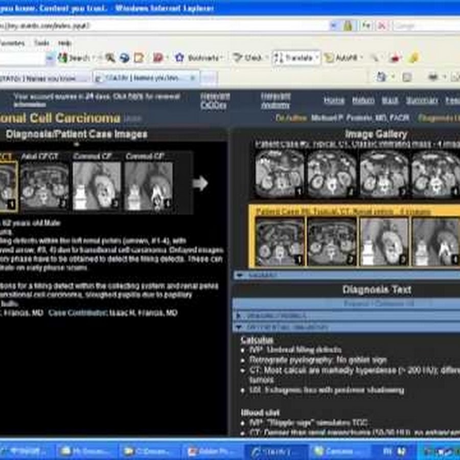 radiology explained YouTube