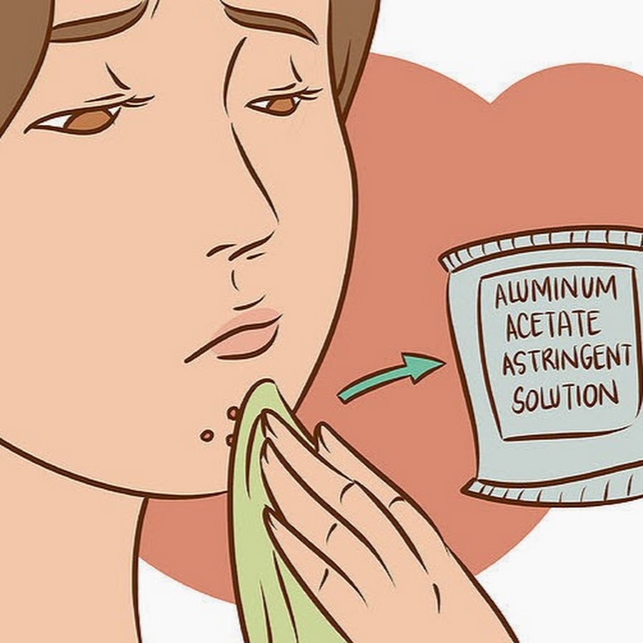 Folliculitis Treatment 