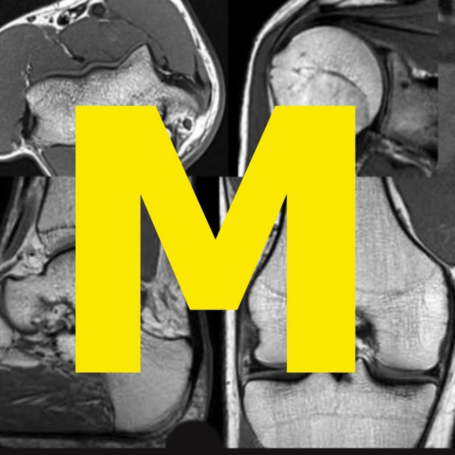 MSK MRI 이지은 영상의학 YouTube