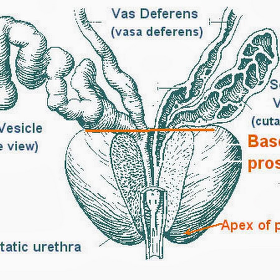 rarp-seminal-vesicles-youtube