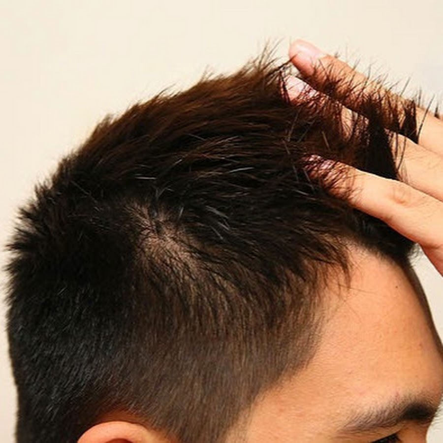 Grow Hair Back - Faster & Effective - YouTube