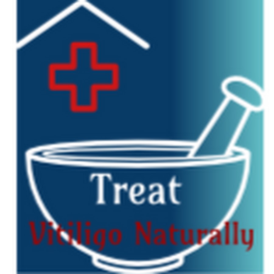 Treat Vitiligo Naturally 