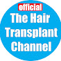 Hair Transplant Joe Tillman