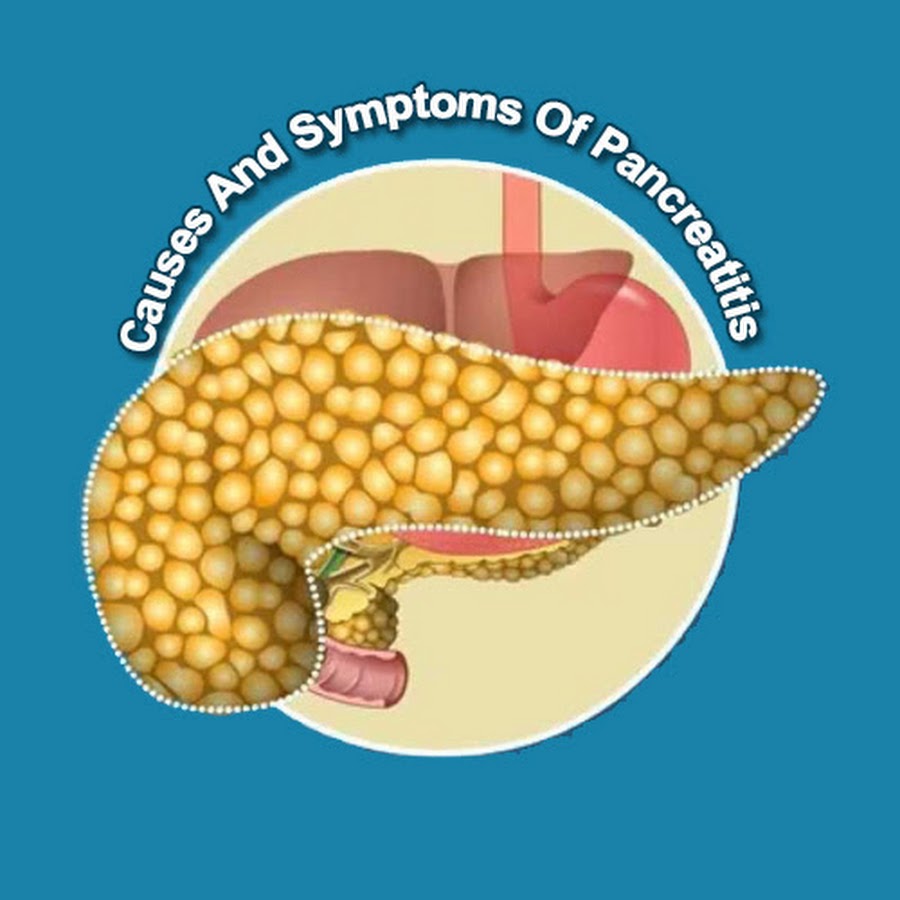Диффузные структурные изменения паренхимы поджелудочной железы. Кальцинаты в селезенке на узи. Паренхима печени диффузно изменена. Узи поджелудочной железы. Паренхима-узи поджелудочной железы.