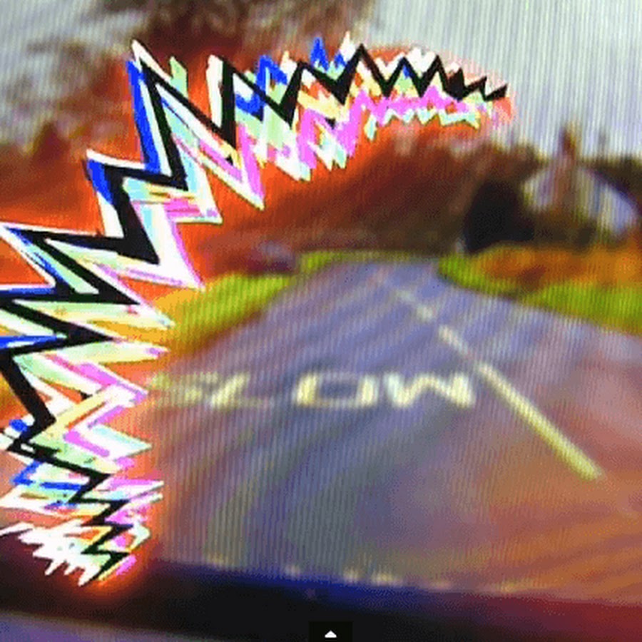 Зигзаг в глазах причины. Мерцательная скотома. Глазная мигрень скотома. Зигзаг в глазах причины. Зрительная скотома мерцающий зигзаг.