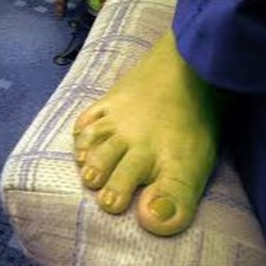 Shreks right foot. 