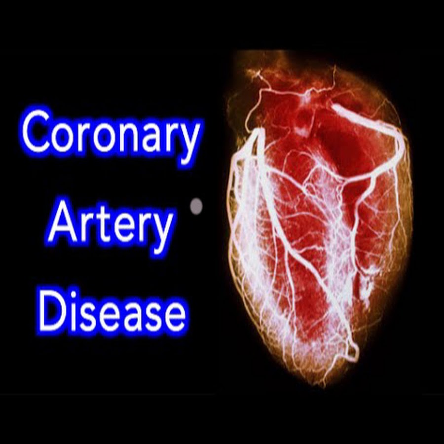 Reversing Heart Disease While Vegan - YouTube