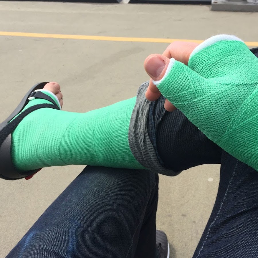 Gips vom Bein - YouTube Gips vom Bein - YouTube