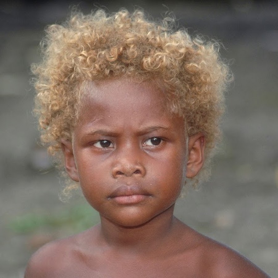 Чернокожая белокожая. Меланезийская раса австралоидная. Австралийская негроидная раса. Африканцы негроидная раса. Австралоидная раса раса.