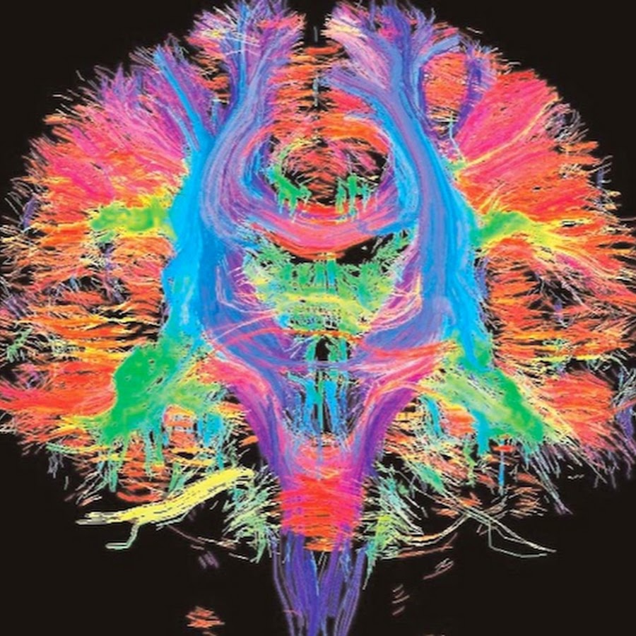 Colored brains. Синестезия мозг. Эпилептические арты. Пространственно-временная синестезия.