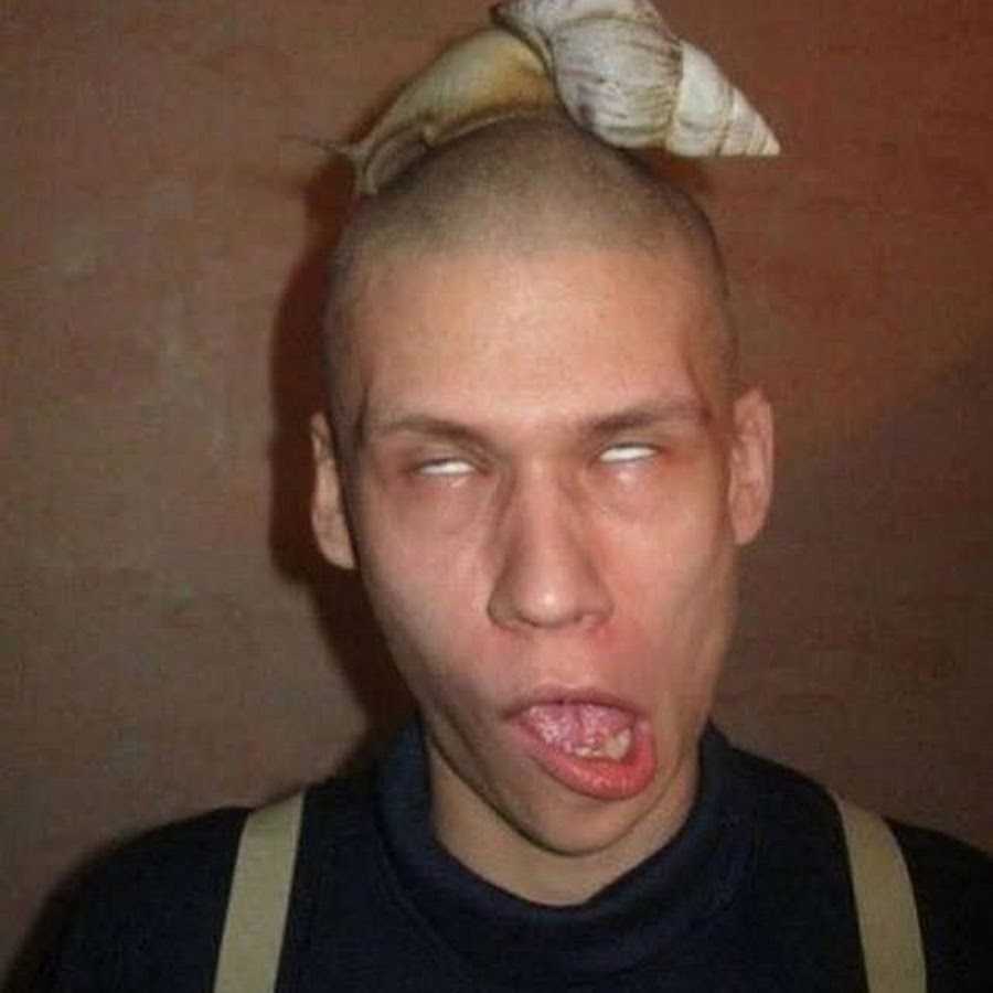 Два друга дебила. Как выглядит идиот. Наоми гроссман пеппер грим. Как выглядит идиот. Два друга дебила.