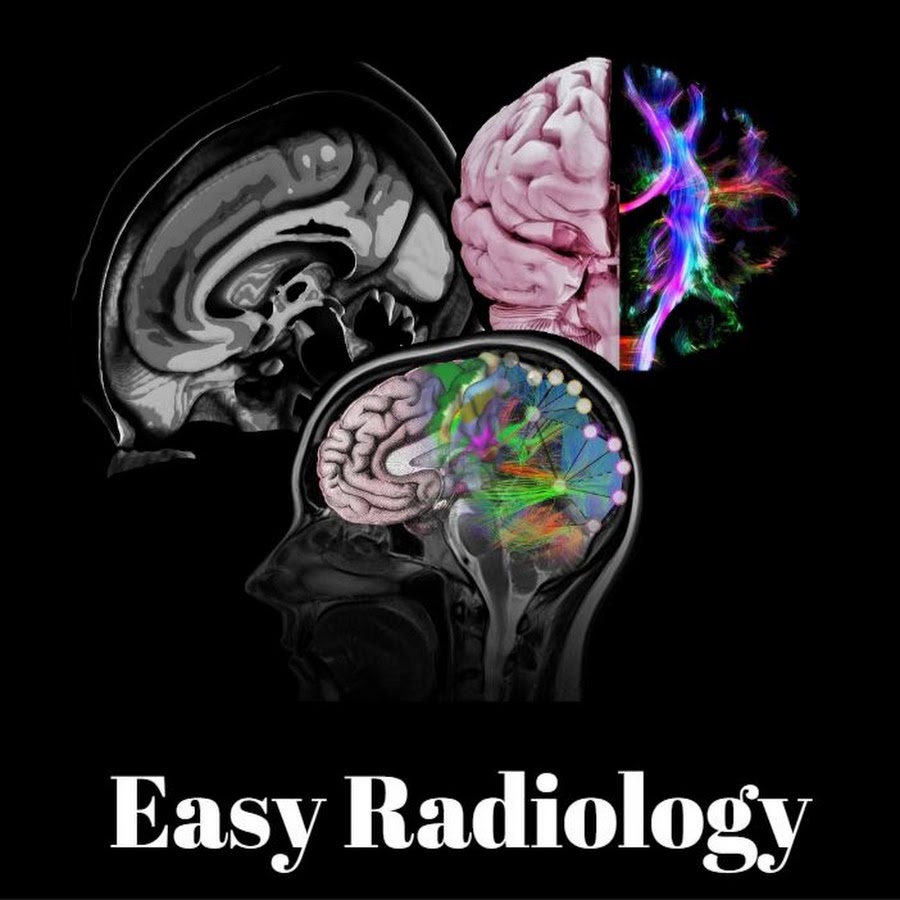 Easy Radiology YouTube