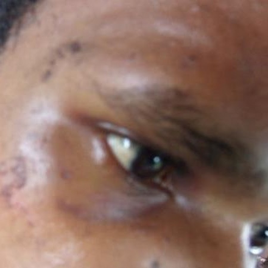 Papua Merdeka News - YouTube