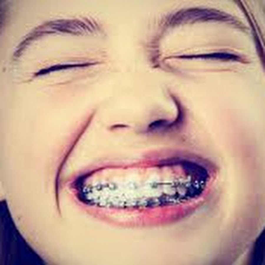 фараон грилзы. страшные брекеты. гриллзы кэти перри. детские брекеты для мальчиков. кэти перри зубы.