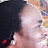 Solluminati's Hairline