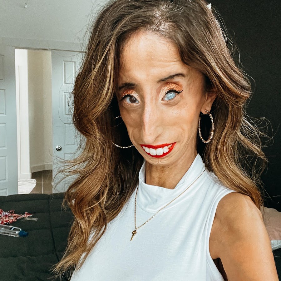 Lizzie Velasquez - YouTube