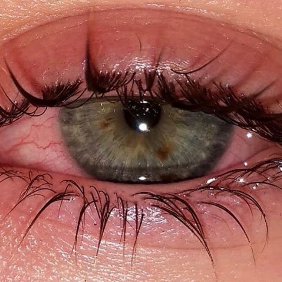 Как убрать заплаканные глаза