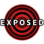 YOUR EXPOSED (your-exposed)