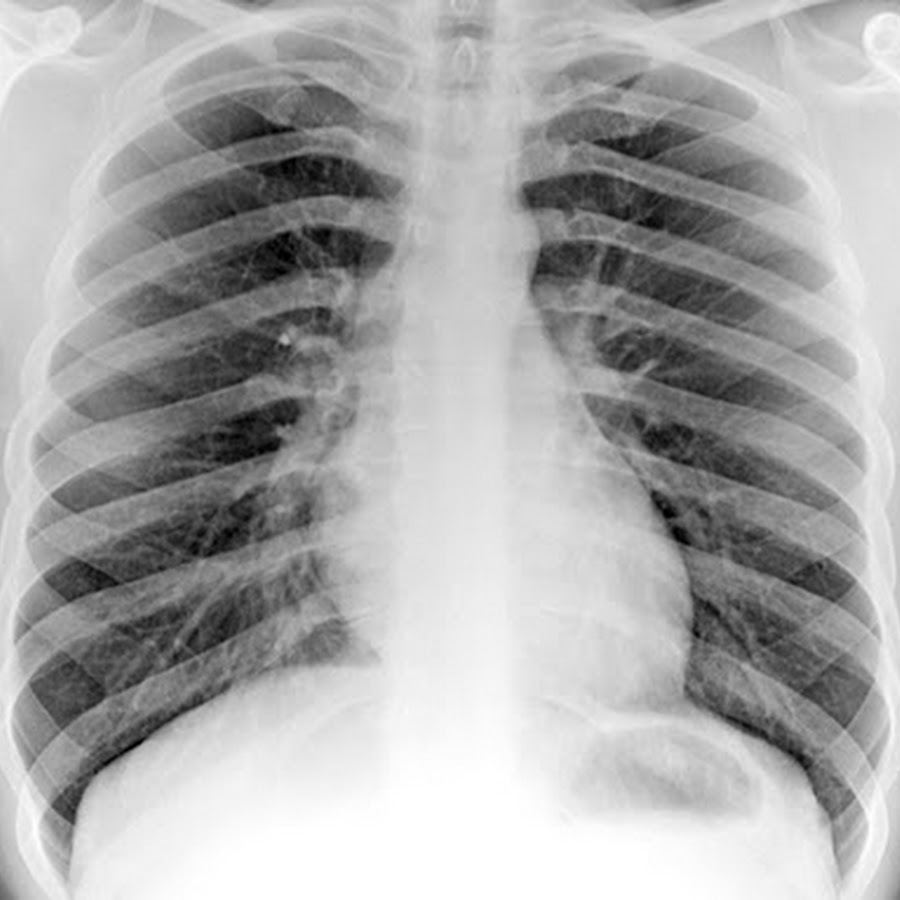 Radiology Masterclass YouTube