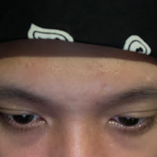 thumbnail img1x1
