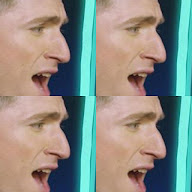 thumbnail img1x1