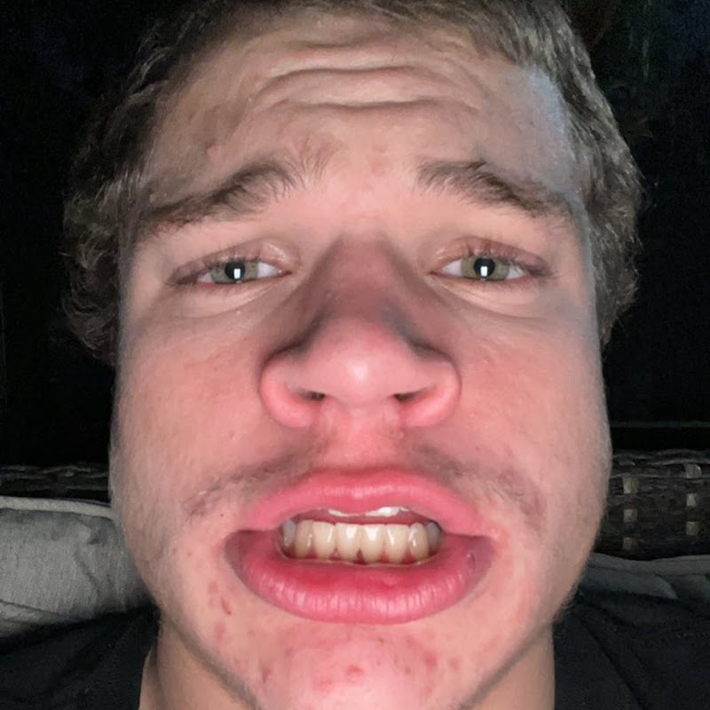 Daily Dose Of Jynxzi