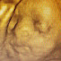 pQlSbIX0C0A-channel-avatar-Ultrasound Chronicle