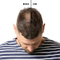 Hair Loss Help logo