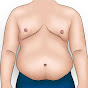 Gynecomastia Stories logo
