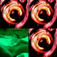 thumbnail img1x1