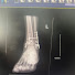 aTedkaJvUVU-channel-avatar-The Broken Ankle