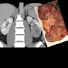 N1XEMMdz9vg-channel-avatar-RadPath Lectures