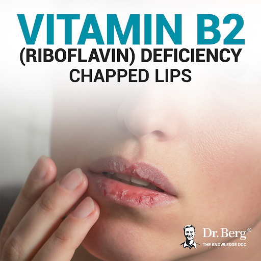 vitamin c deficiency chapped lips What Causes Dry Lips? HOW DEFICIENCY CAN CHANGE YOUR