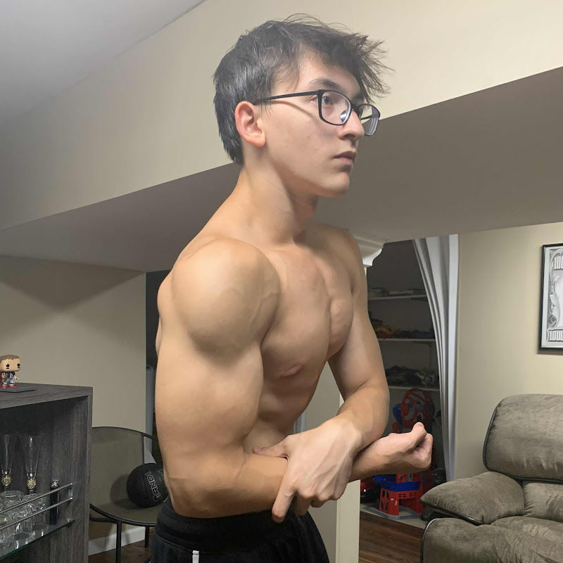 Anthony 