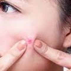 スキンケア - ニキビ治療の専門家  アイコン画像