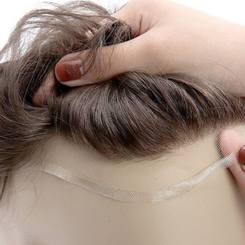  Hair patch & Fixing Chennai 