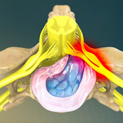 БЕЛ ГРИЖАНИ 1 КУНДА ДАВОЛАШ
