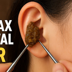 耳垢取り-ASMR耳かきアイコン画像