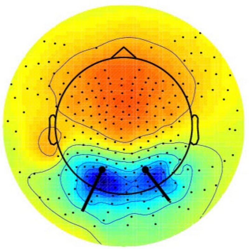 EEGLAB and EEG Neurotech
